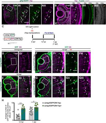 Yap Regulates Müller Glia Reprogramming in Damaged Zebrafish Retinas